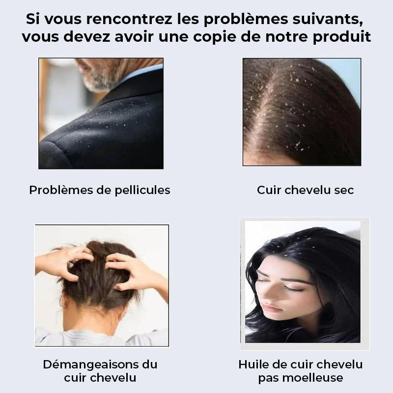 Peigne de massage antipelliculaire